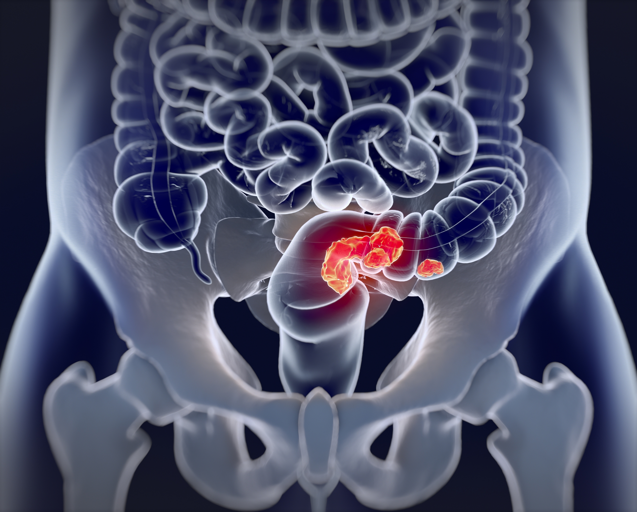 Gastroenterology